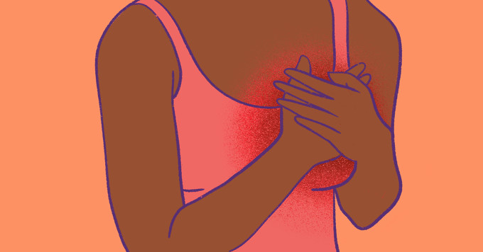 What is Inflammatory Breast Cancer? image