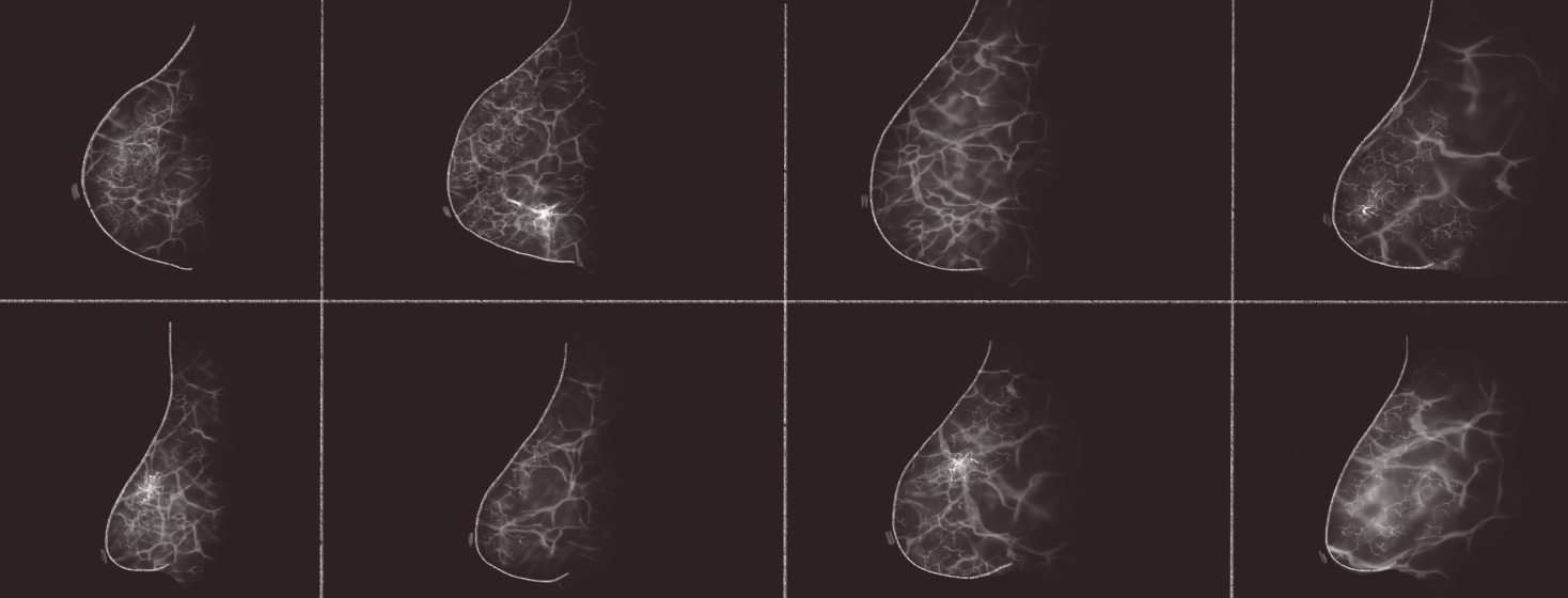 A collection of mammography images